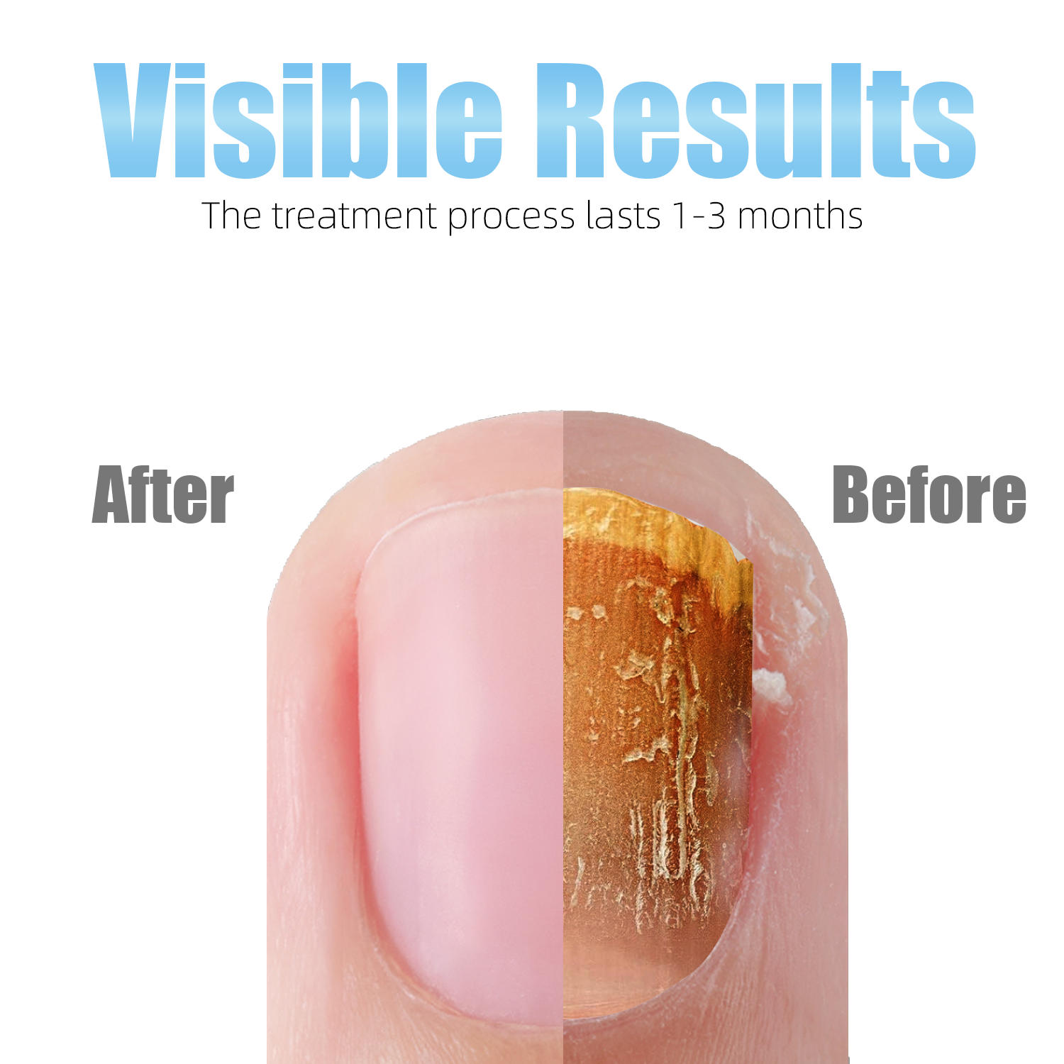 Nail Fungus Cleaning Device